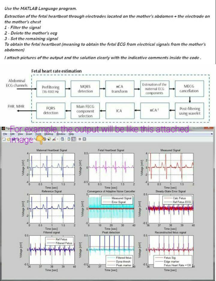 Solved Use the MATLAB Language program. Extraction of the | Chegg.com