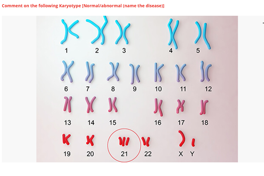 Solved Comment on the following Karyotype [Normal/abnormal | Chegg.com