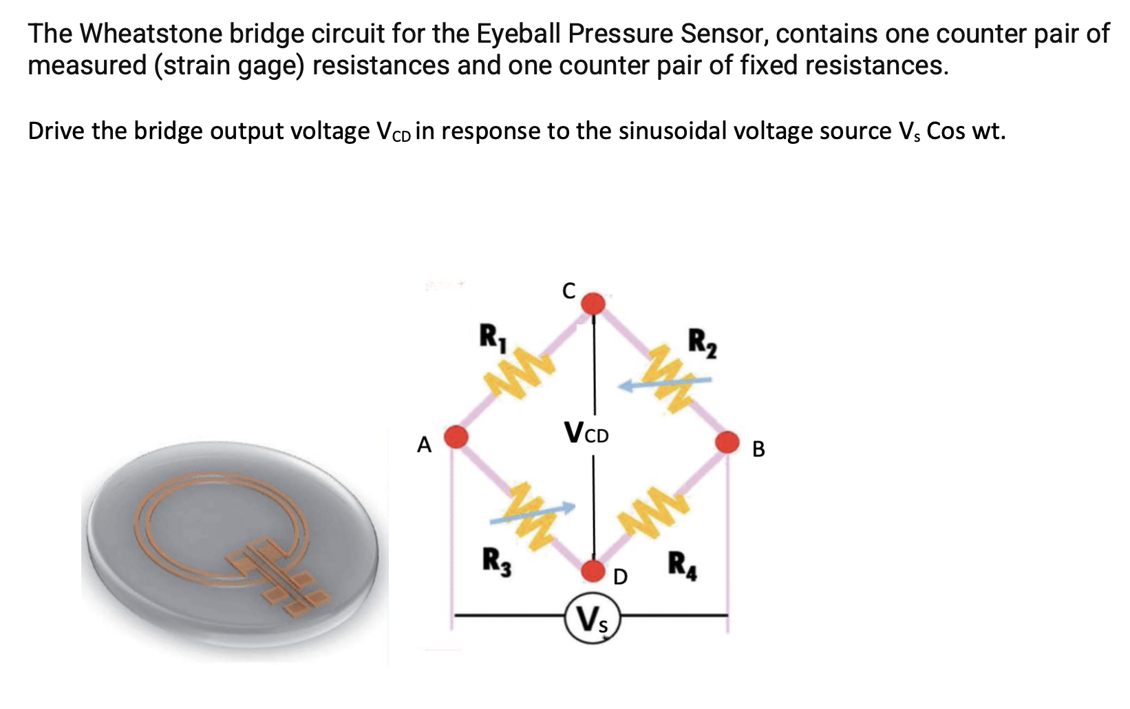 Solved The Wheatstone bridge circuit for the Eyeball | Chegg.com