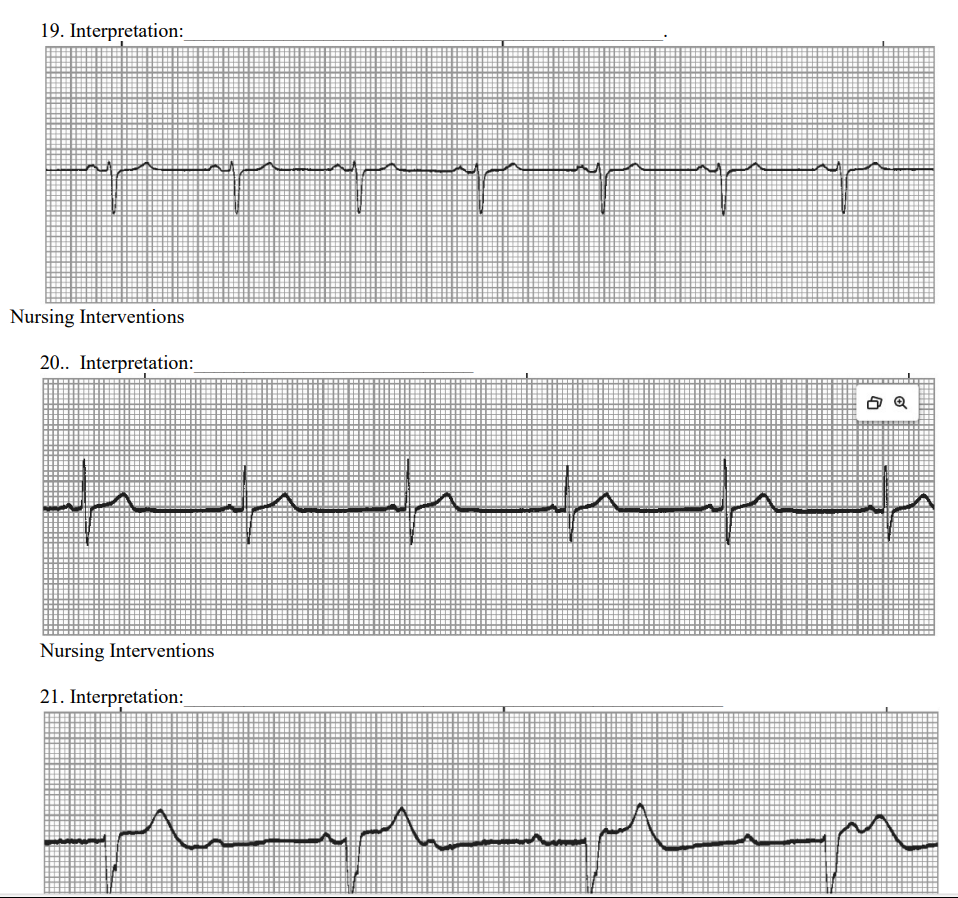 Solved What are these rhythms | Chegg.com