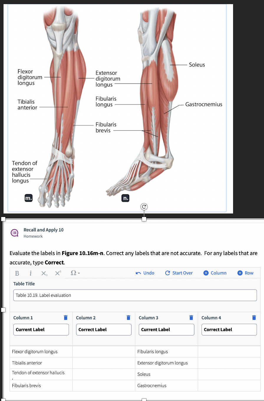 Solved Soleus Flexor digitorum longus Extensor digitorum | Chegg.com