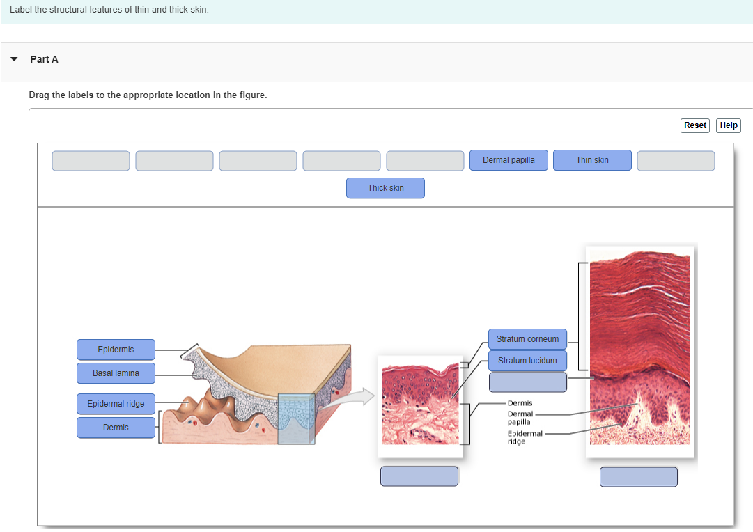 solved-label-the-structural-features-of-thin-and-thick-skin-chegg