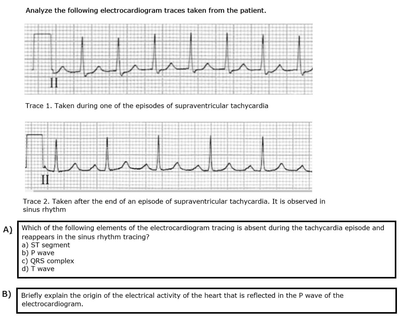 Solved Analyze the following electrocardiogram traces taken | Chegg.com