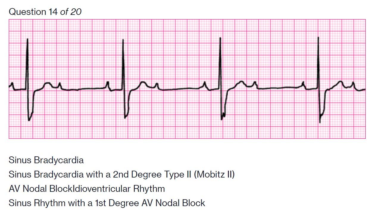 Solved Question 14 of 20 سلیمہ Sinus Bradycardia Sinus | Chegg.com