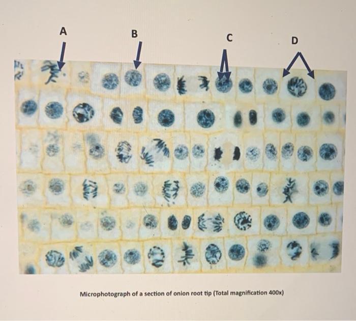 Solved Use the microphotograph of a section of onion | Chegg.com