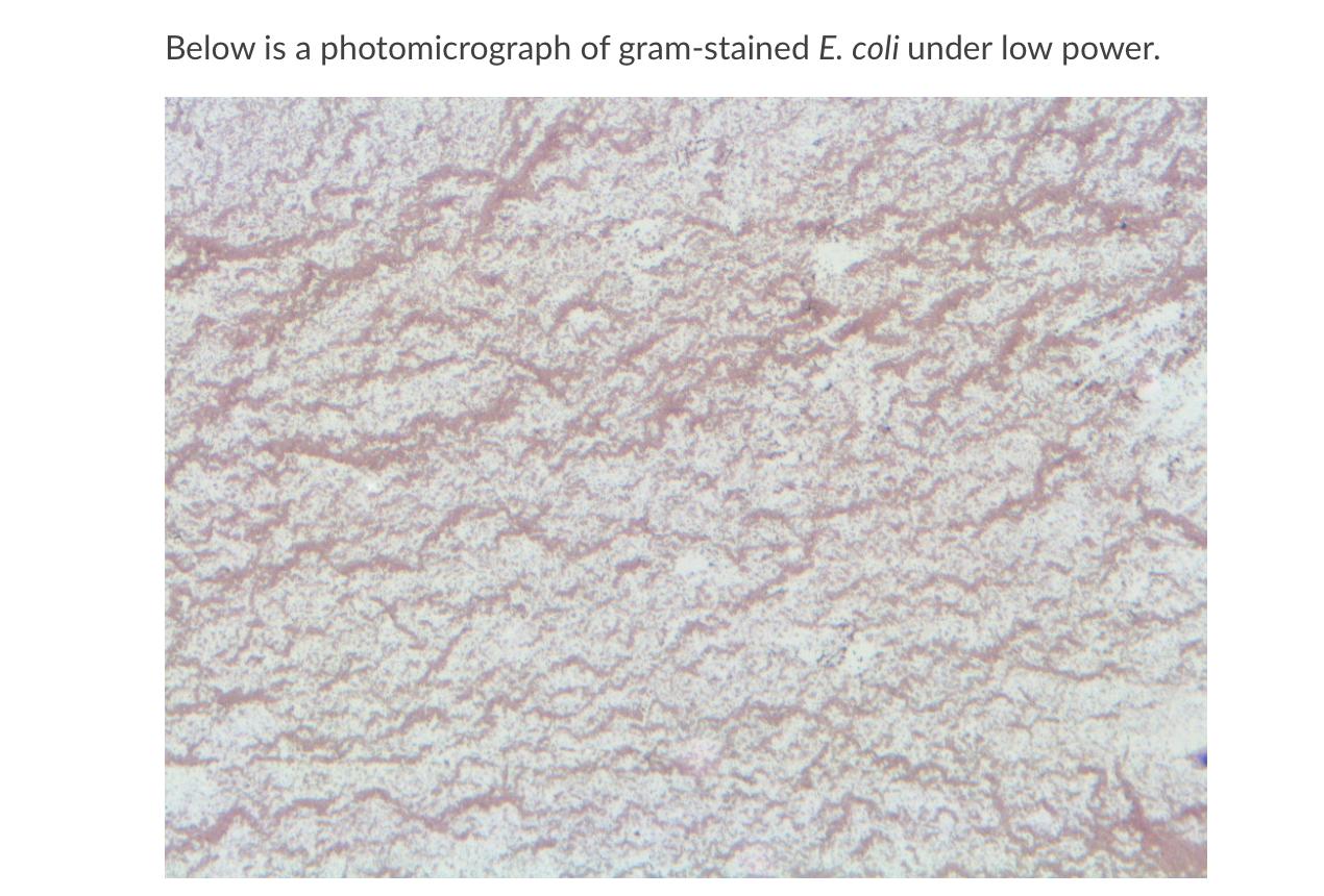 Solved What Shape Do These Bacterial Cells Have What Is Chegg Com