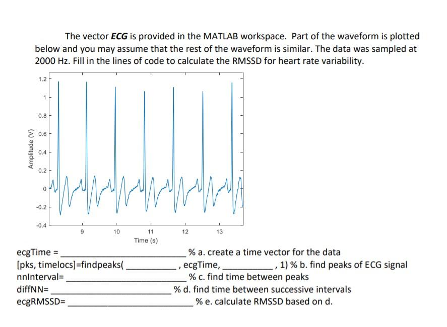 The vector ECG is provided in the MATLAB workspace. | Chegg.com