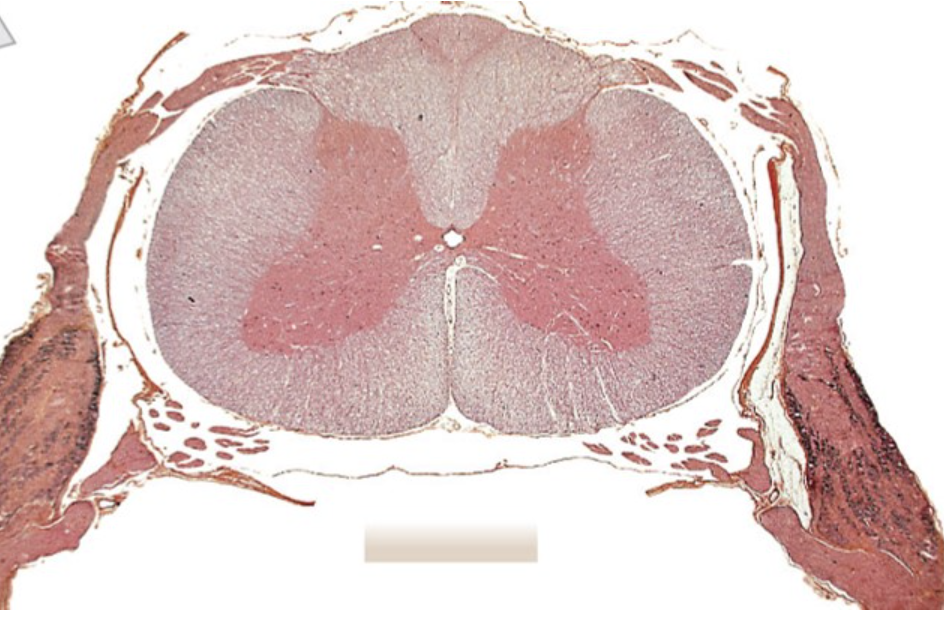 Solved Where in this image does the region of the spinal | Chegg.com