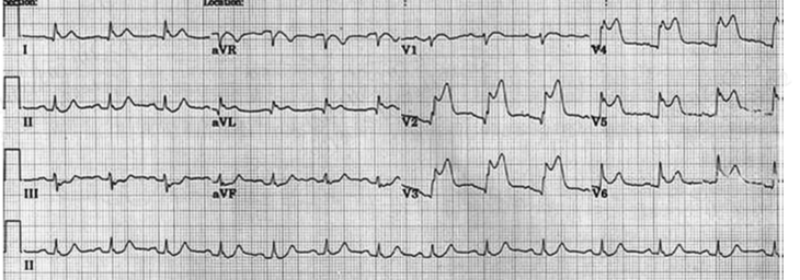 Solved 1- What is the most likely diagnosis of the following | Chegg.com