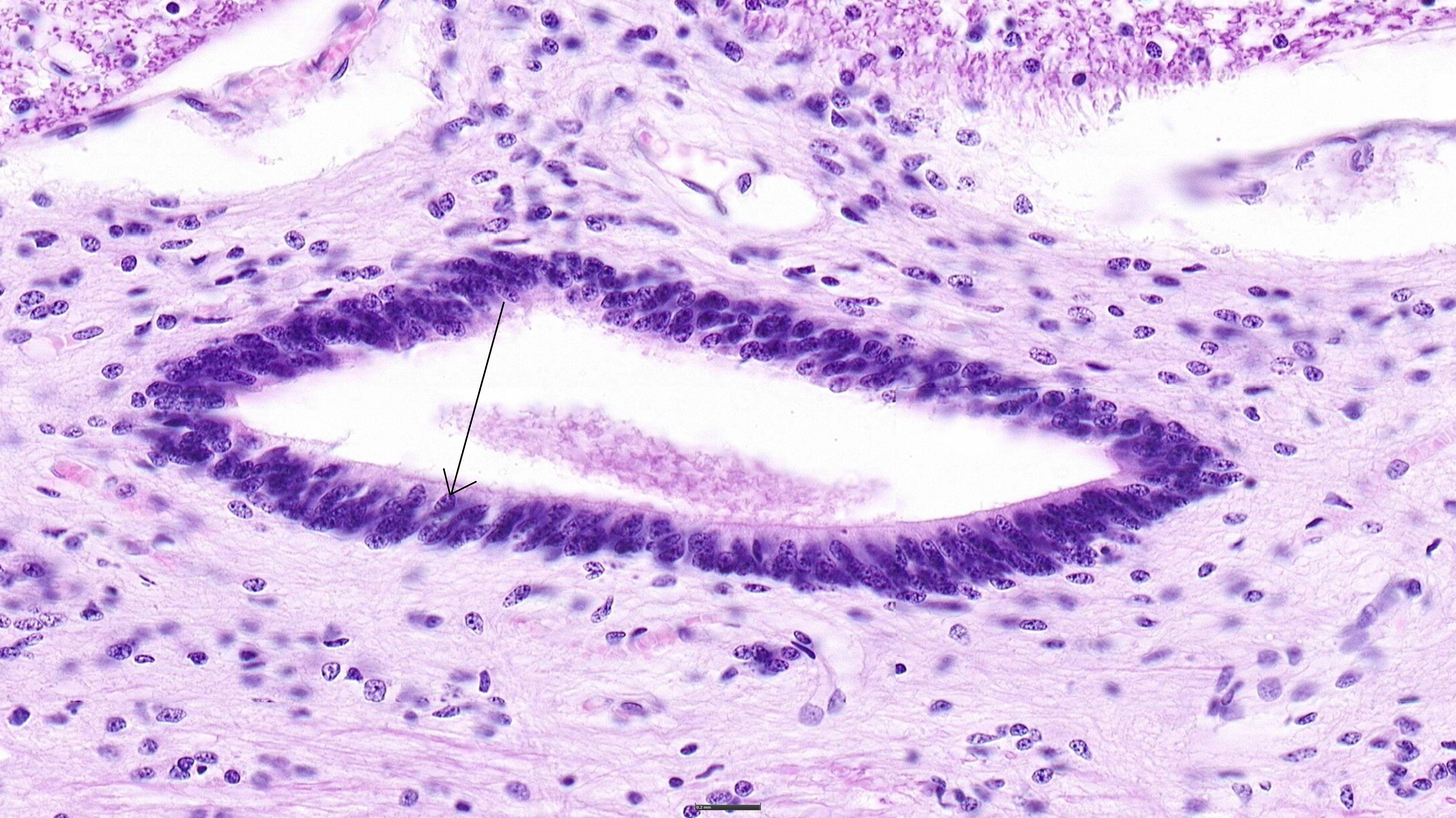 ependymal cells histology