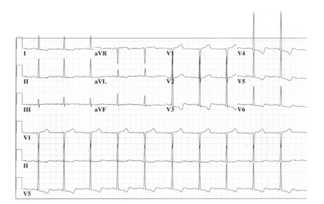 Solved The following use case are in relation to the ECG | Chegg.com