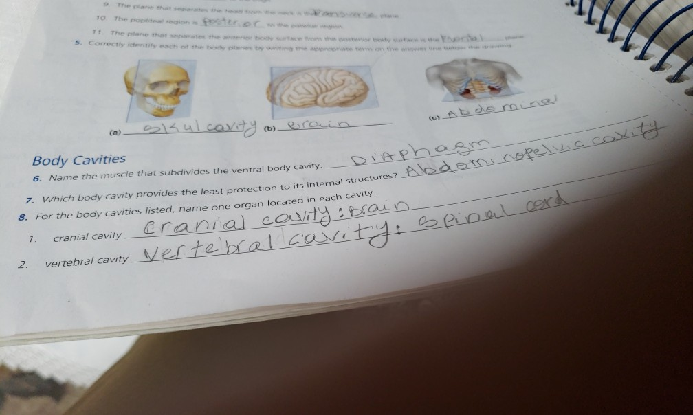 What Muscle Subdivides The Ventral Body Cavity Brennan Has Reeves