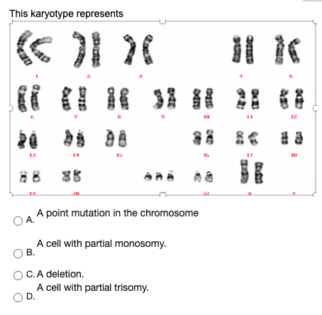 monosomy 13