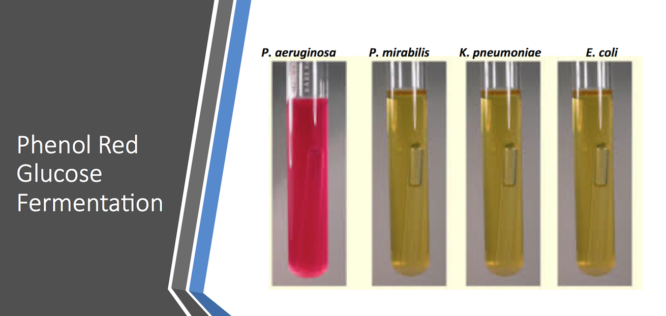 Solved Exercise 5 Clinical Test of GramNegative