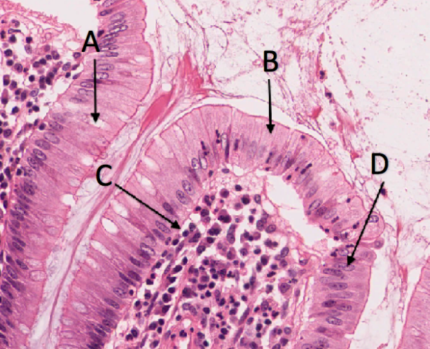 Solved LABEL EPITHELIAL Options: Basement Membrane, A-Band, | Chegg.com