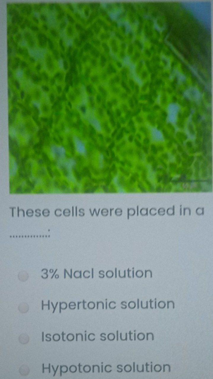 hypertonic nacl 3 solution ncc