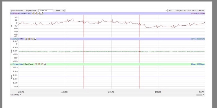Solved How does the average T-P interval from rest to each | Chegg.com