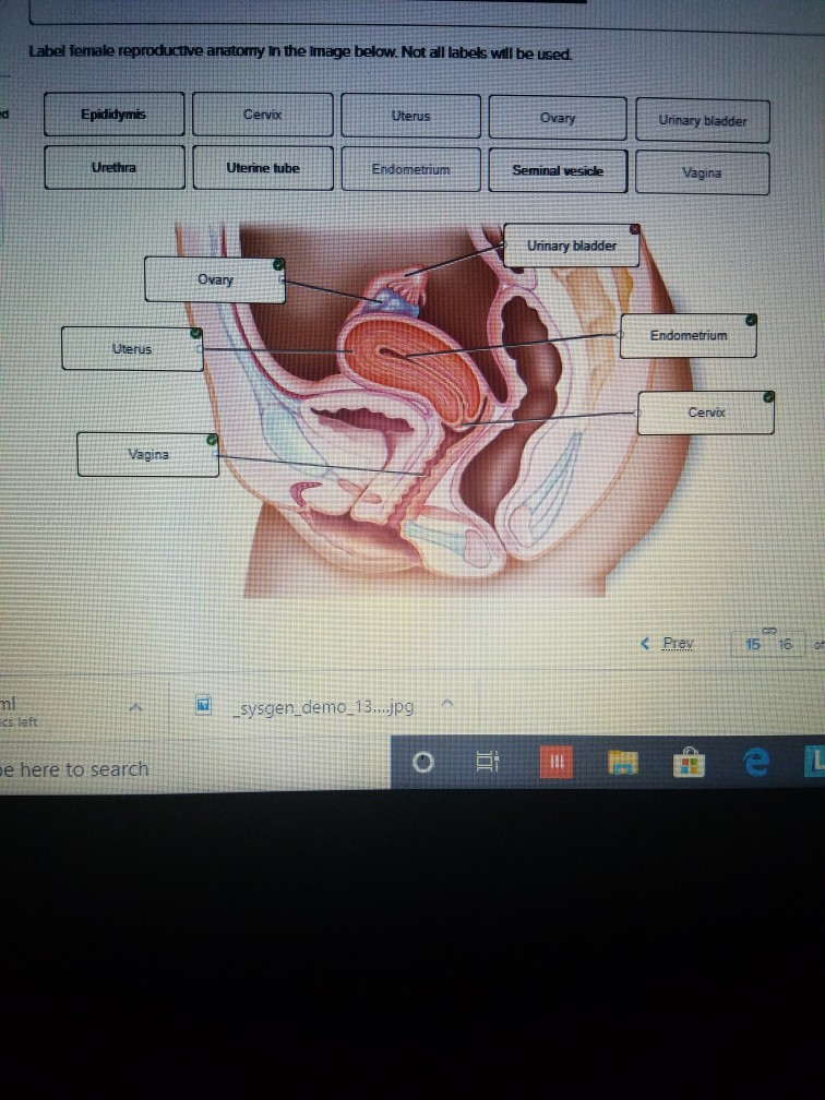 Uterus homework image