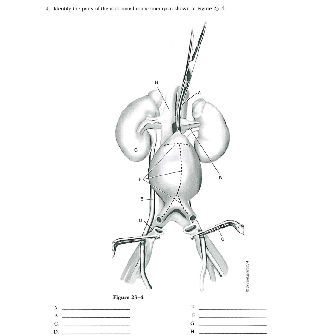 Solved 1. Identify the parts of the capillary bed shown in