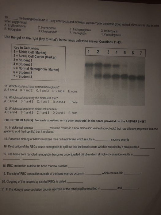 Solved: Experiment 102: Sickle Cell Anemia Worksheet PLACE... | Chegg.com