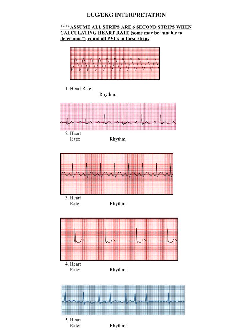 ECG/EKG INTERPRETATION ****ASSUME ALL STRIPS ARE 6 SECOND STRIPS WHEN CALCULATING HEART RATE (some may be unable to determin