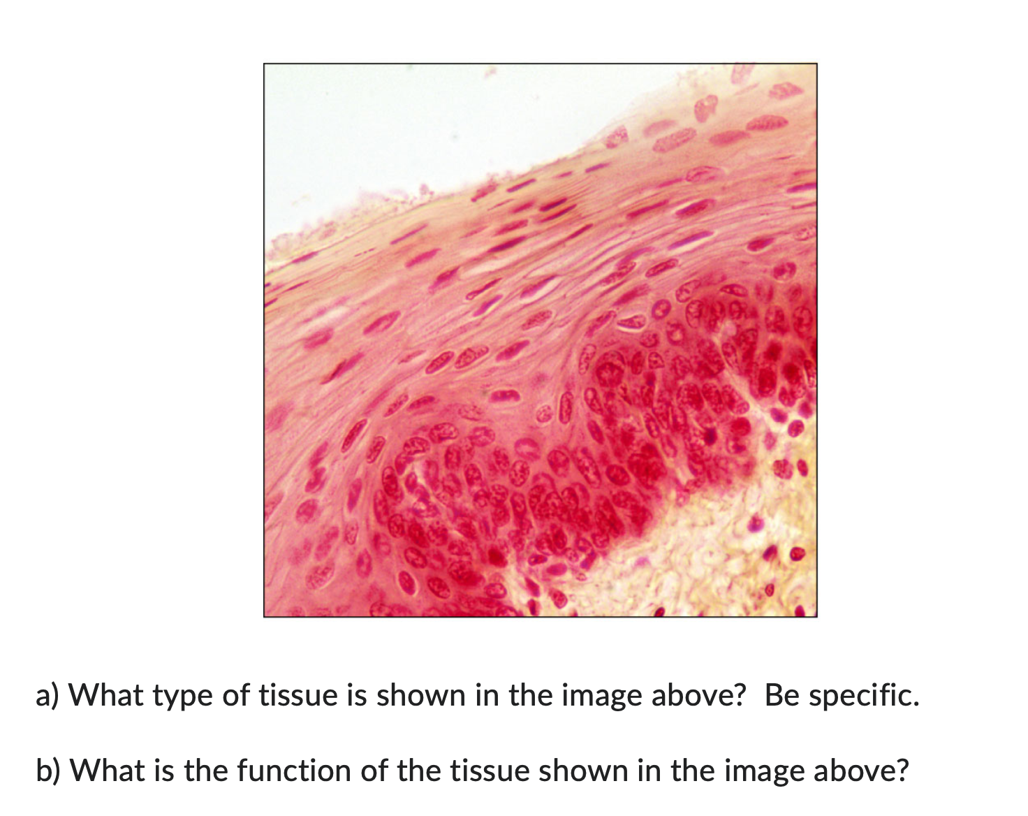 solved-a-what-type-of-tissue-is-shown-in-the-image-above-chegg