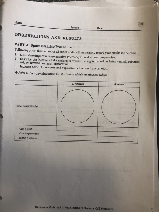 Solved 95 AcidFas Staining LABORATORY REPORT ?AcidFast