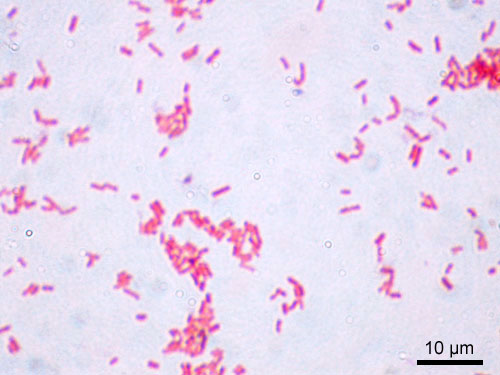 Solved I Included The Lab Report And Lab Pictures E Coli