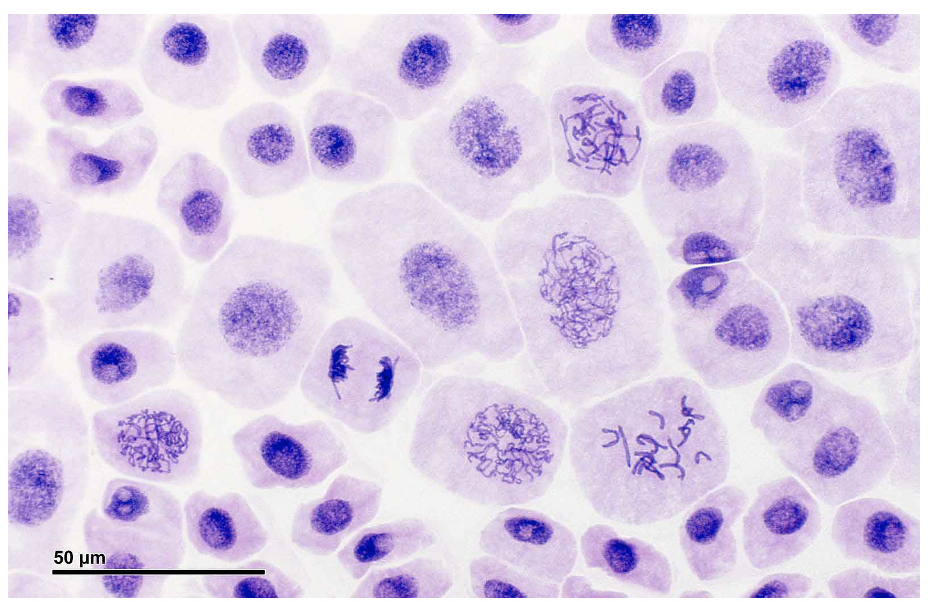 Solved Mitosis 1. Calculate the Mitotic Index for this Biology Diagrams