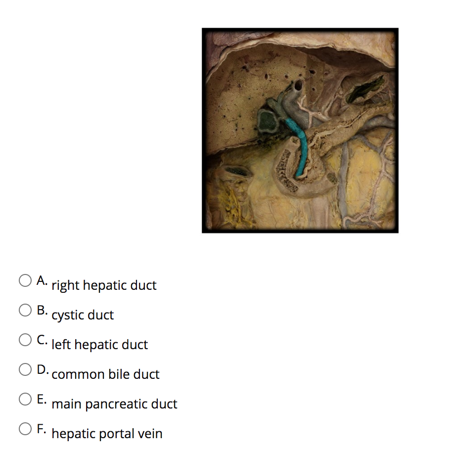 left main hepatic duct