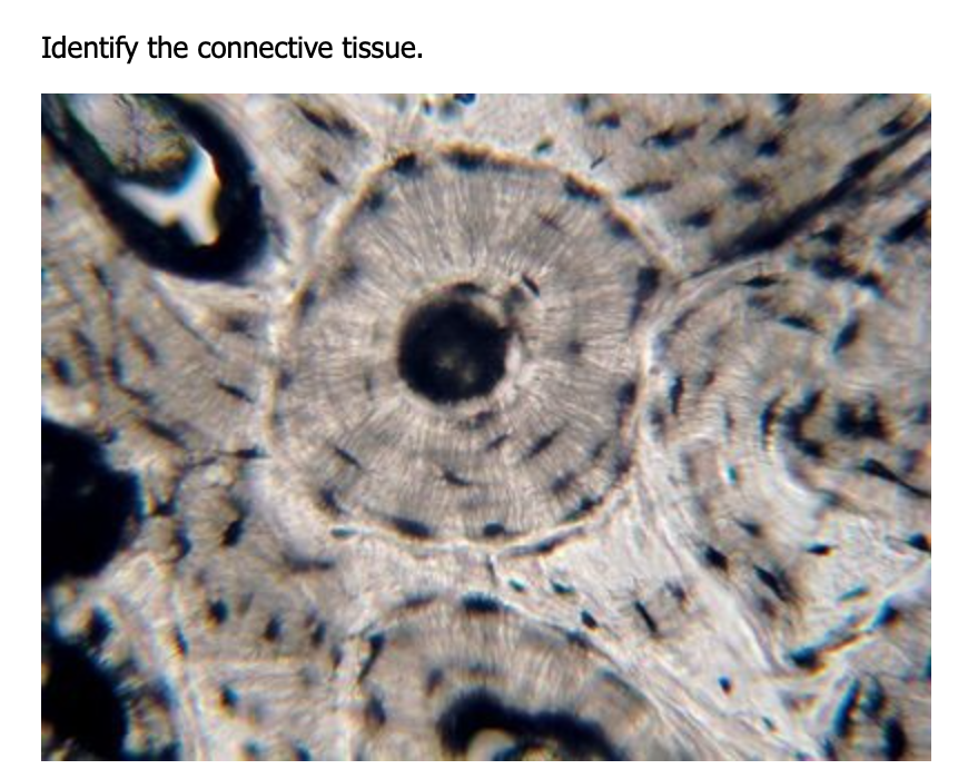 Solved Identify The Connective Tissue. | Chegg.com