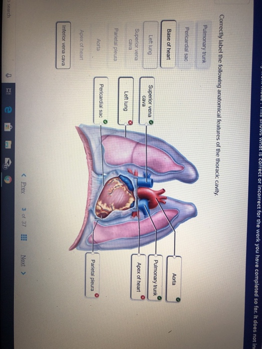 Tis Siows What Is Correct Or Incorrect For The Work Chegg 