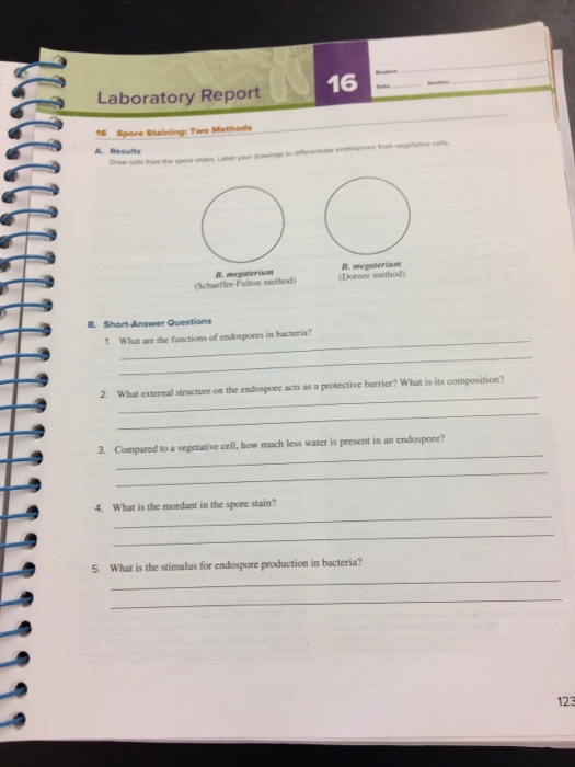 Solved Laboratory Report 16 16 Spore Staining Twe Methods A