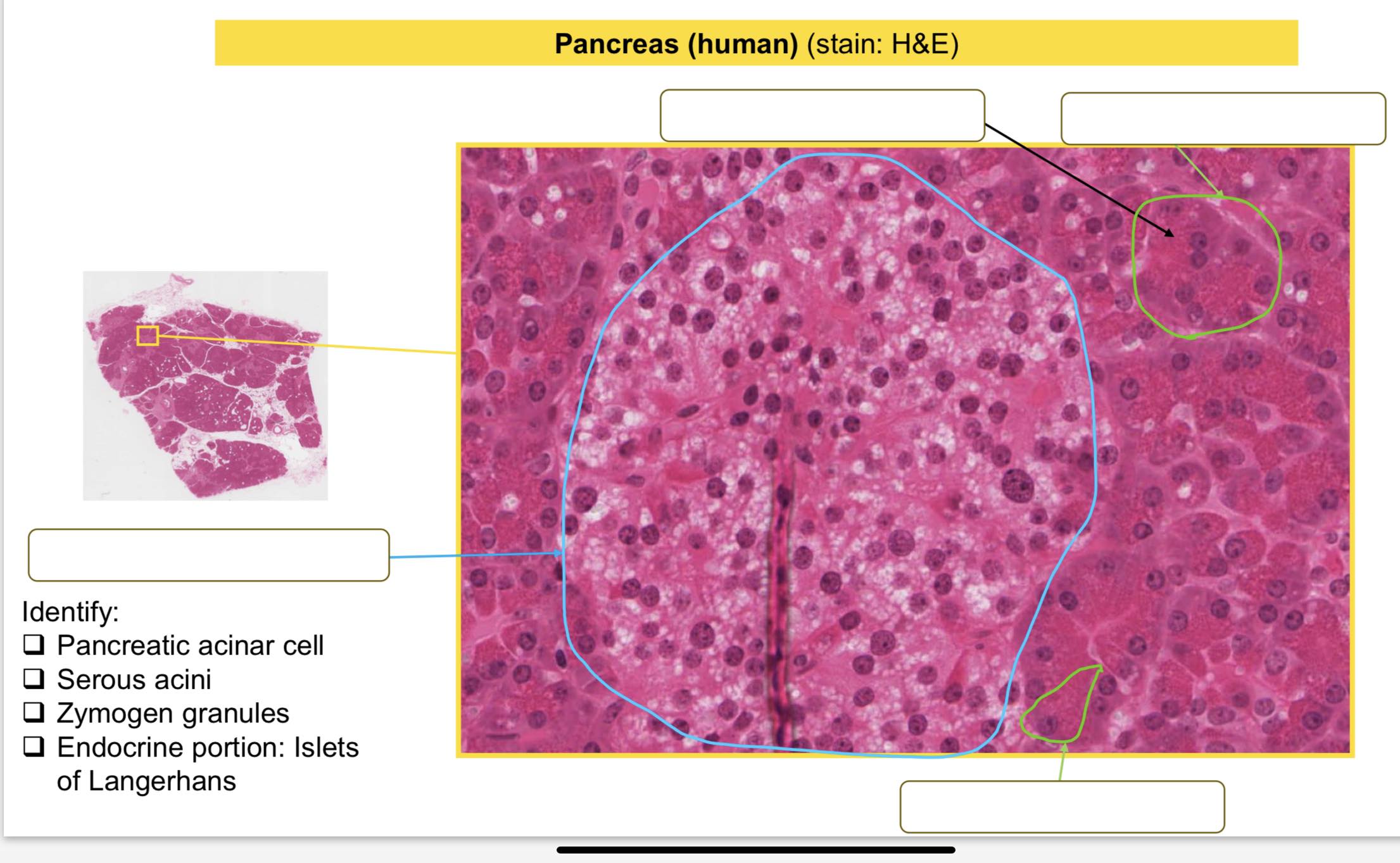 Solved Identify:Identify: Hepatocytes Kupffer cells | Chegg.com