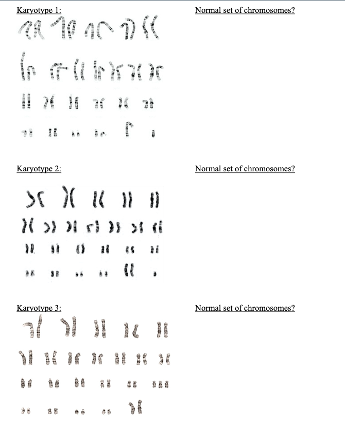 Solved 2A. Humans normally have 23 pairs of chromosomes. | Chegg.com