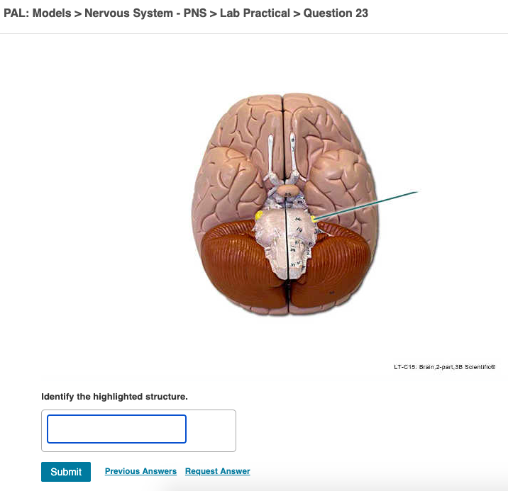 Solved PAL: Models > Nervous System – PNS > Lab Practical > | Chegg.com”><br /> <span><i>Source Image: chegg.com</i></span> <br /><a href=