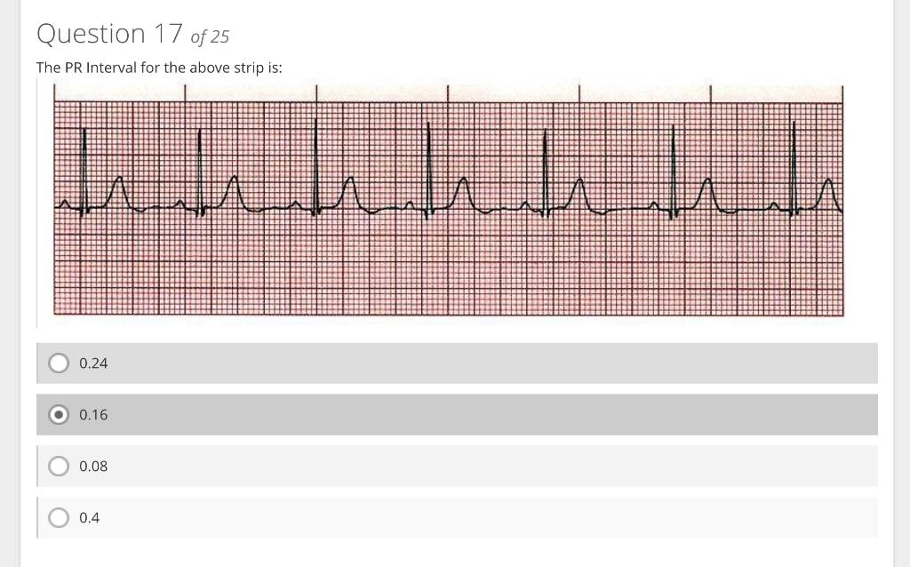 The PR Interval for the above strip is:
\( 0.24 \)
\( 0.16 \)
\( 0.08 \)
\( 0.4 \)