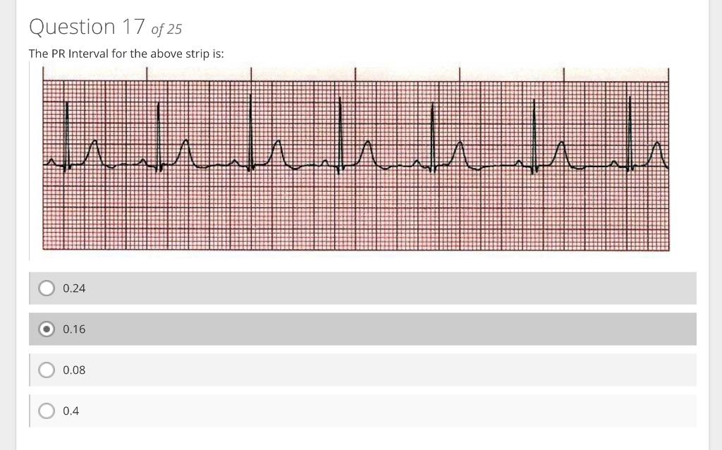 The PR Interval for the above strip is:
\( 0.24 \)
\( 0.16 \)
\( 0.08 \)
\( 0.4 \)