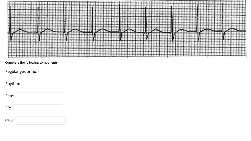 Complete the following components: Regular yes or no: Rhythm: Rate: PR: QRS: