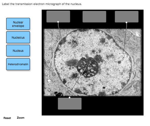 top 95+ Pictures label the transmission electron micrograph of the cell Sharp