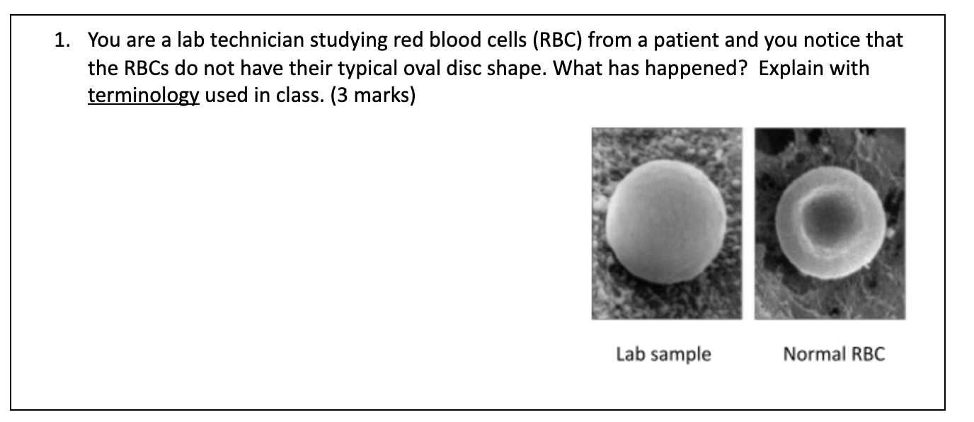 Solved 1. You are a lab technician studying red blood cells | Chegg.com