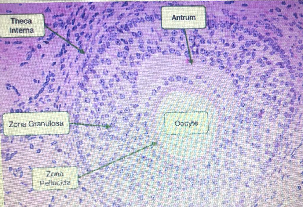 Solved #1) On micrographs A, B, and C: -indicate where the | Chegg.com