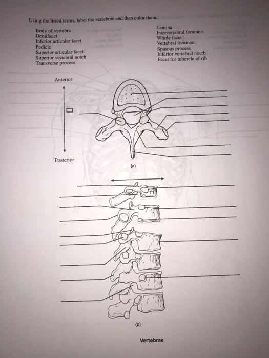 Solved Examine the vertebra, label it, and color its | Chegg.com