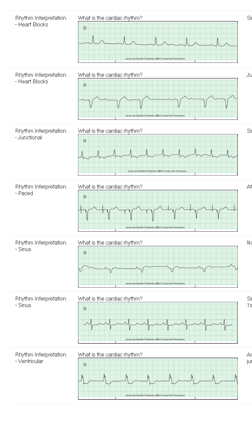 Subject Question F What is the cardiac rhythm? Rhythm