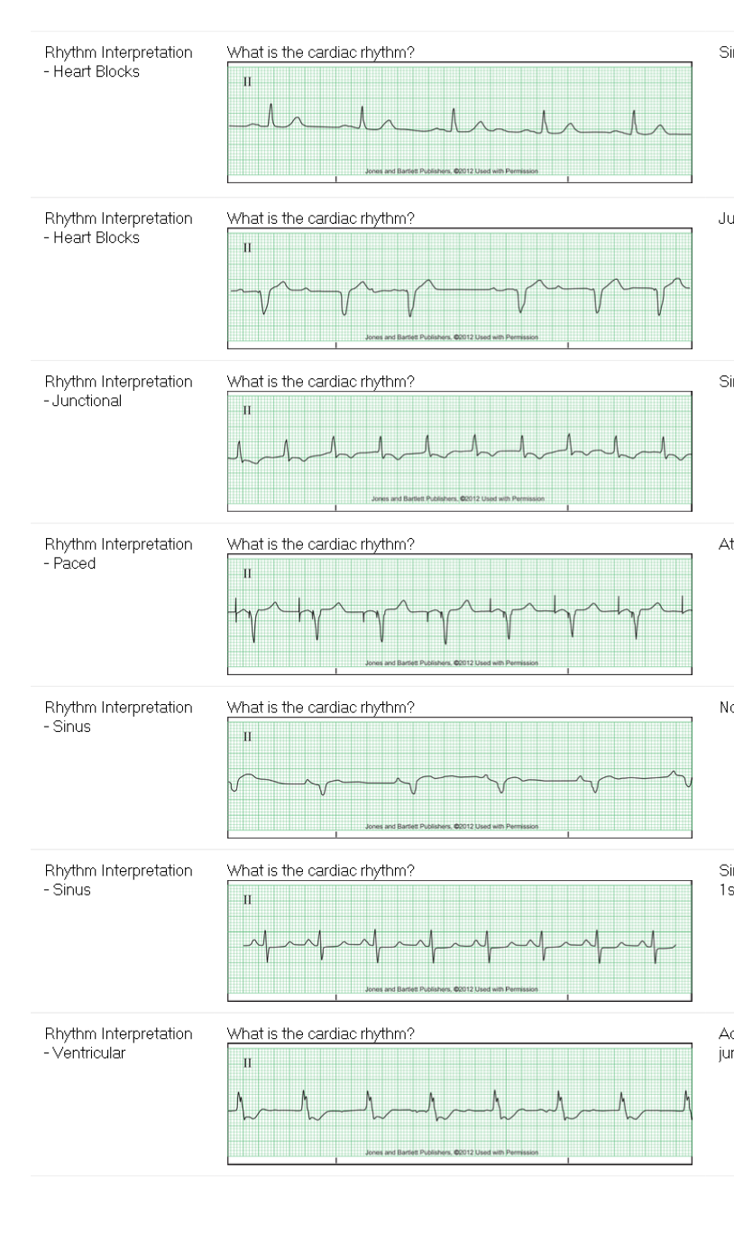 Subject Question F What is the cardiac rhythm? Rhythm | Chegg.com