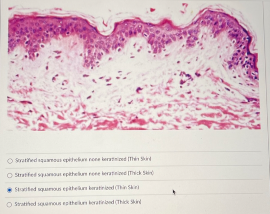 stratified squamous epithelium keratinized skin