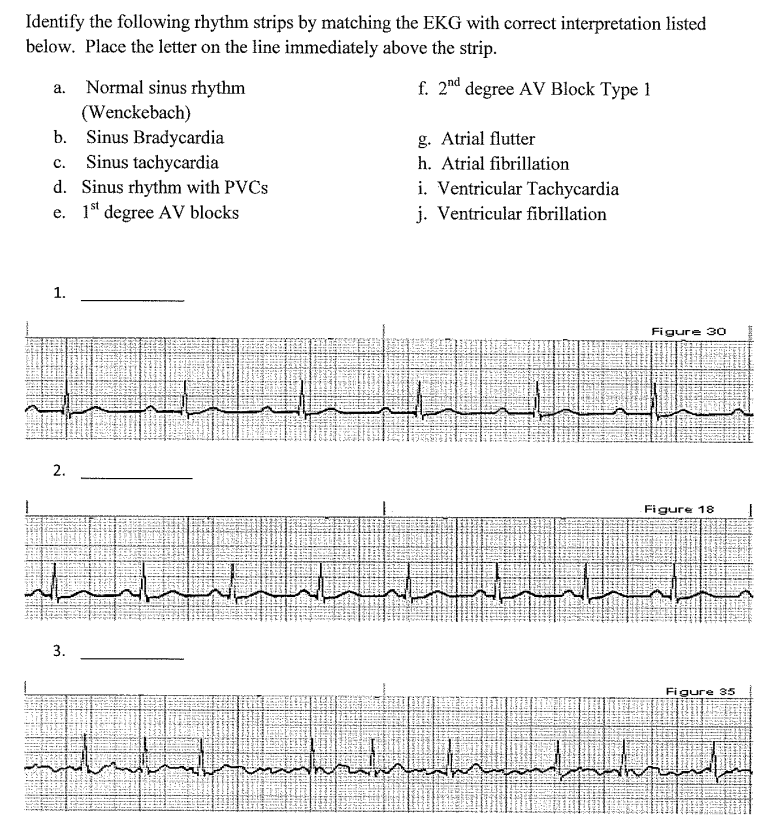 Solved Identify The Following Rhythm Strips By Matching The | Chegg.com