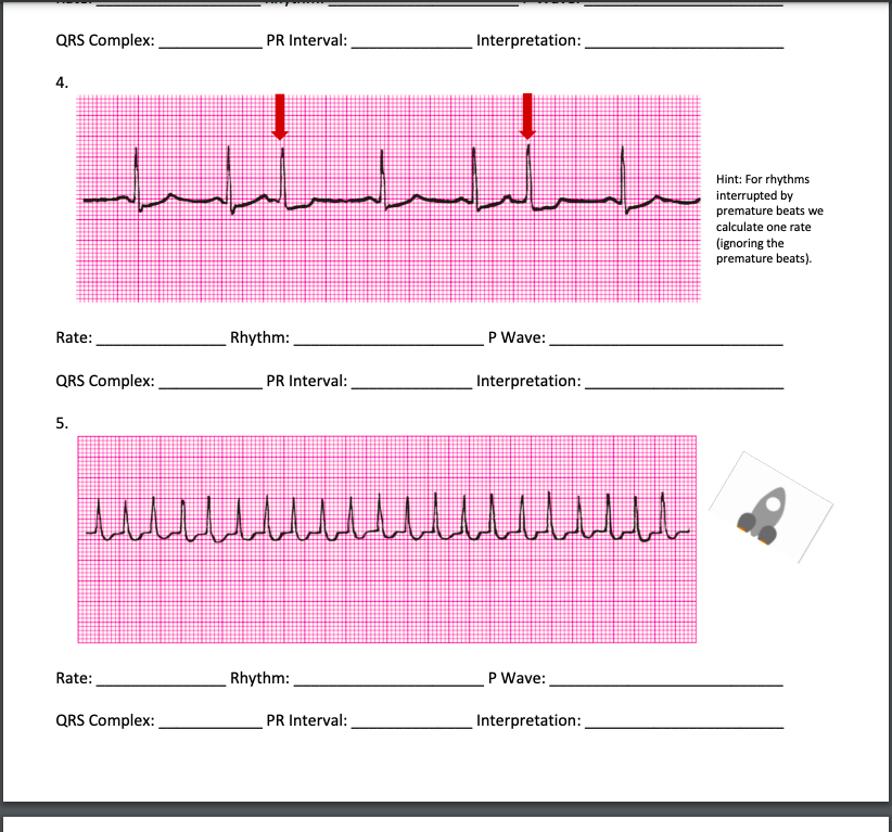 Solved Instructions: Evaluate each rhythm using the 5-step | Chegg.com