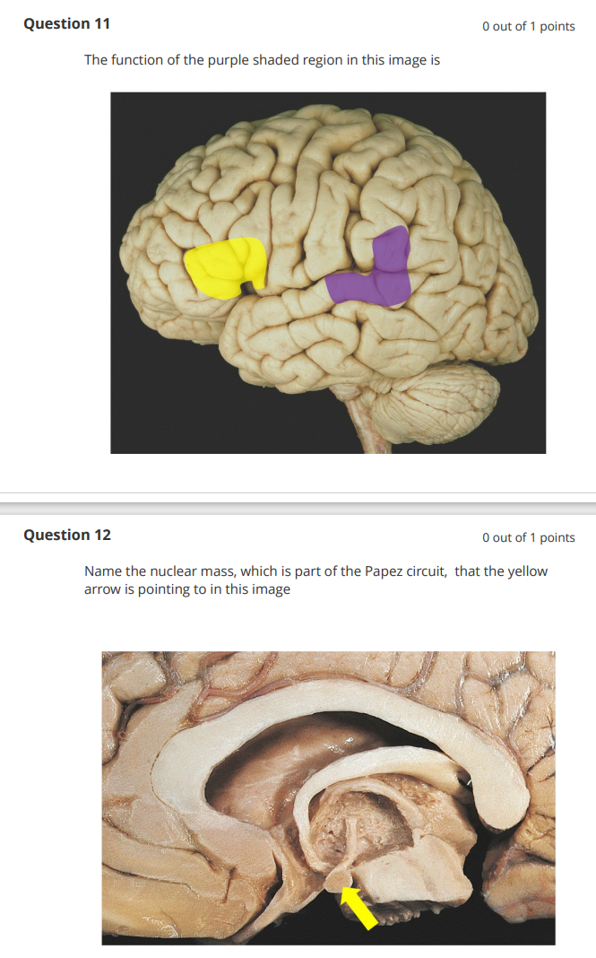 Question 11
0 out of 1 points
The function of the purple shaded region in this image is
Question 12
0 out of 1 points
Name th