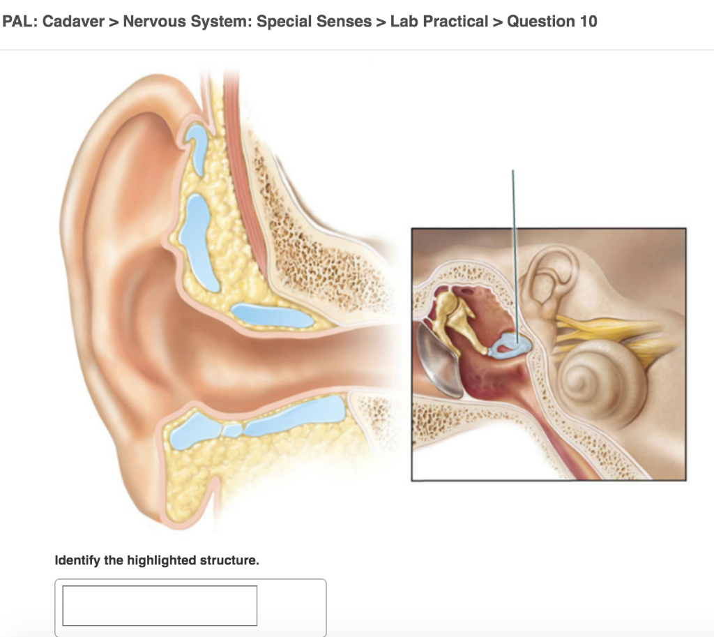 SOLVED: PAL: Cadaver > Nervous System: Special Senses > Lab Practical